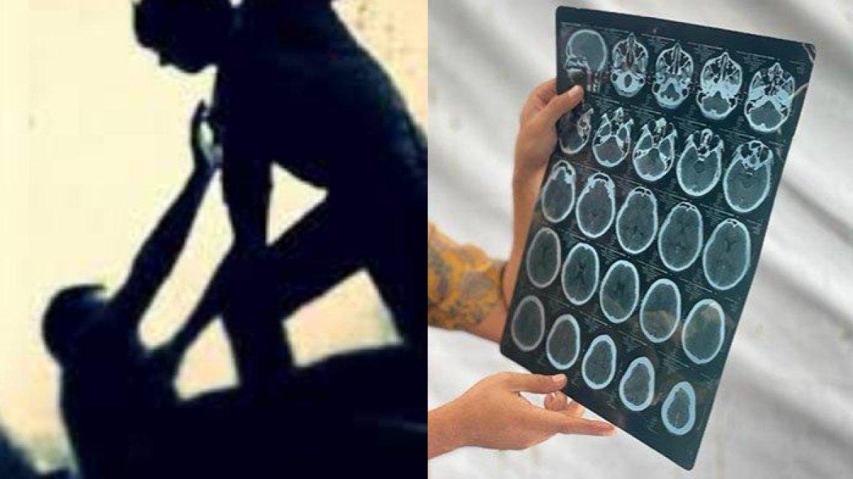 SISWA SMA di Aceh Dibully Kakak Kelas & Guru, Badan Korban Jatuh Kepala Ditendang hingga Pendarahan