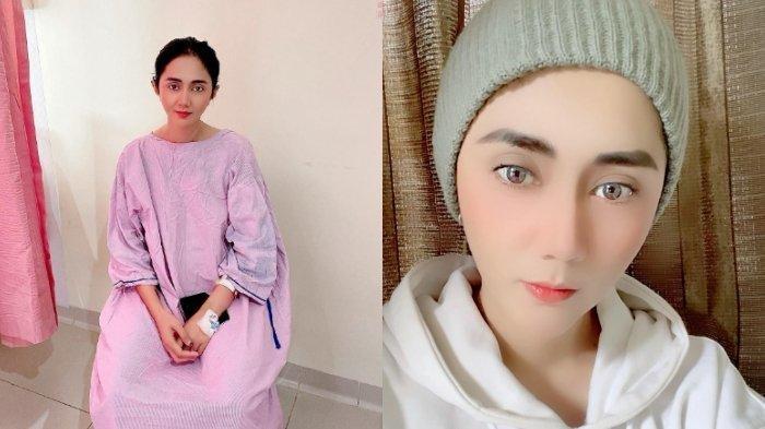 Kepala Aida Saskia nyaris botak lantaran rambutnya rontok usai kemoterapi