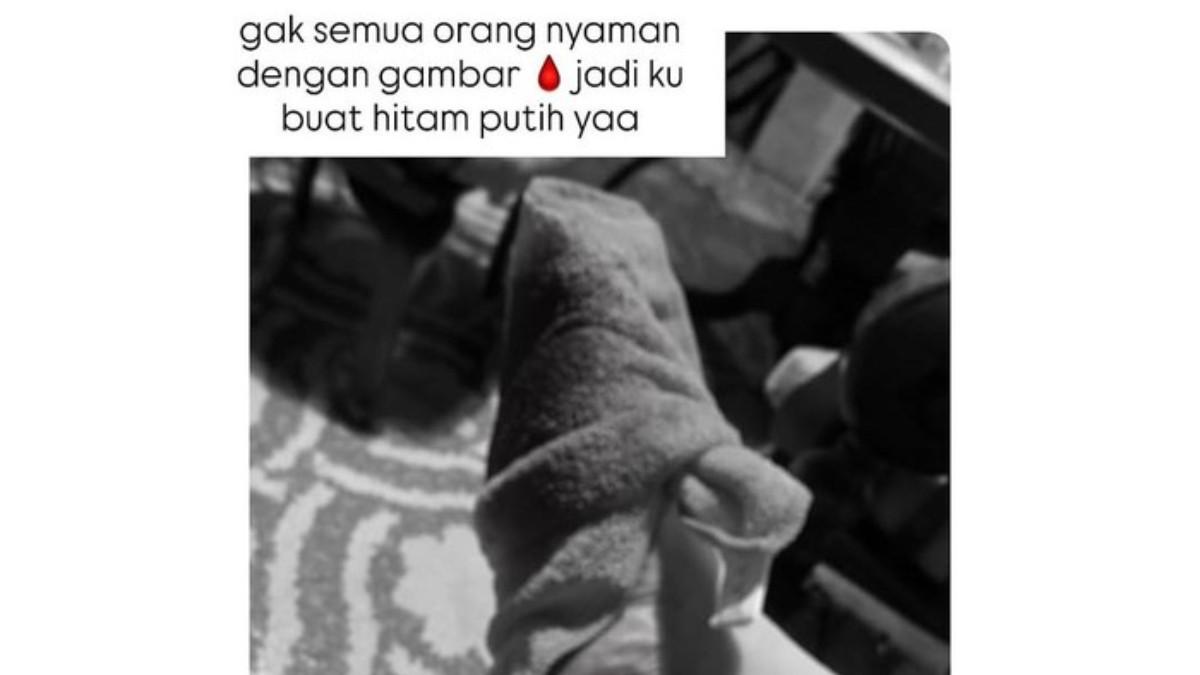 KABAR ASMIRANDAH - Kondisi kaki Asmirandah saat mendapatkan pertolongan pertama dari suaminya, Jonas.