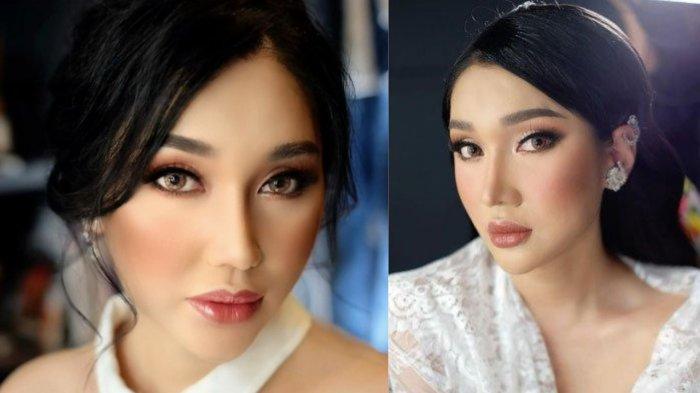 Pengakuan Lucinta Luna Jalani Operasi Payudara, Takut Ketahuan Palsu, Igun: Kayak Ada Jahitannya