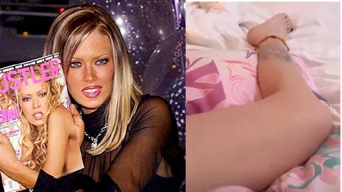 Nasib Bintang Panas yang Kini Didiagnosa Penyakit, Tak Bisa Berjalan & Kaki Sampai Terlihat Kurus