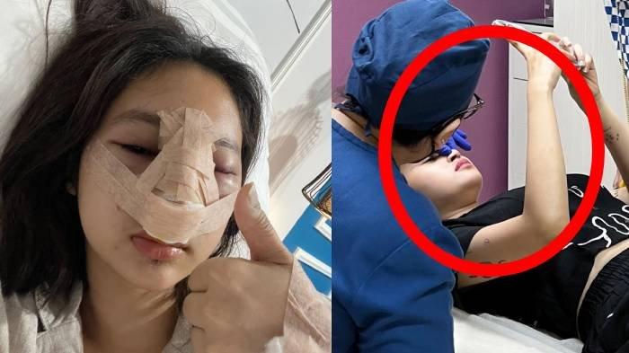 Nasib Permesta Dhyaz, putri Youtuber Farida Nurhan setelah oplas