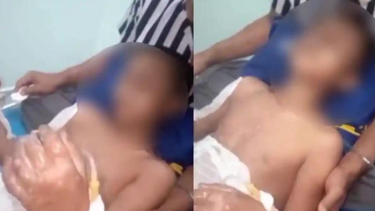 DIUSUT POLISI - Kondisi santri diduga menjadi korban perundungan atau bullying di salah satu Pondok Pesantren (Ponpes) yang berlokasi di Kabupaten Lombok Tengah. Sebelum dibakar, para santri korban terlebih dahulu disiram menggunakan bensin.