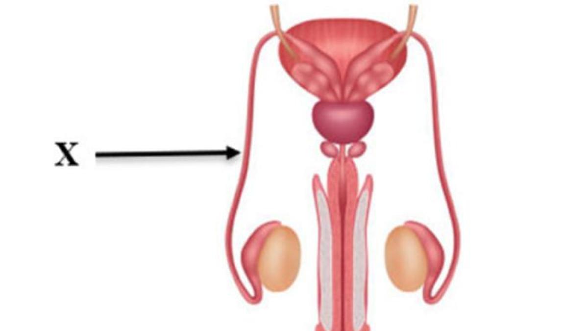 gambar alat reproduksi laki-laki sebagai soal TKA Biologi SMA Kelas 12