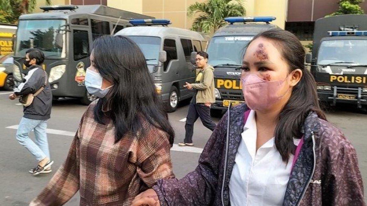 'Ada yang Dadahin Saya' Wanita di Kebayoran Baru Pilu Ditabrak Pacar Cemburu Buta, Kini Lapor Polisi