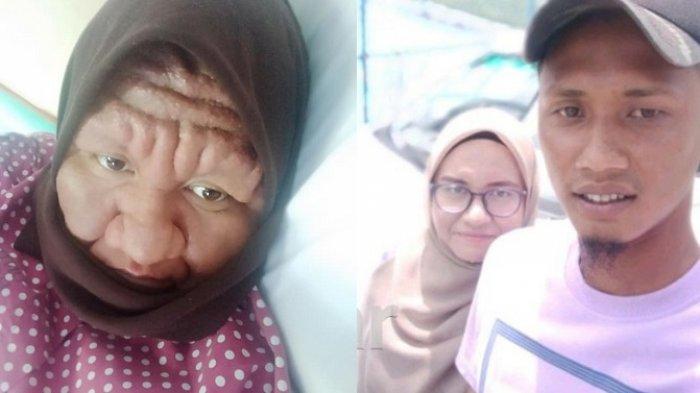 Wajah Berubah Drastis Selama Hamil, Wanita Jadi Korban Nyinyir Tetangga, Suami: Kamu Tetap Cantik
