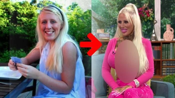 Kisah Wanita yang Melakukan Operasi Plastik Total pada Wajah & Tubuhnya, Demi Lakukan Pekerjaan Ini