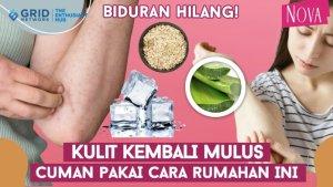 Cara-alami-atasi-biduran.jpg