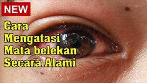 Cara-mengatasi-mata-belekan.jpg