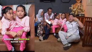 Keduanya-hidup-dengan-tubuh-dempet-dari-bayi.jpg