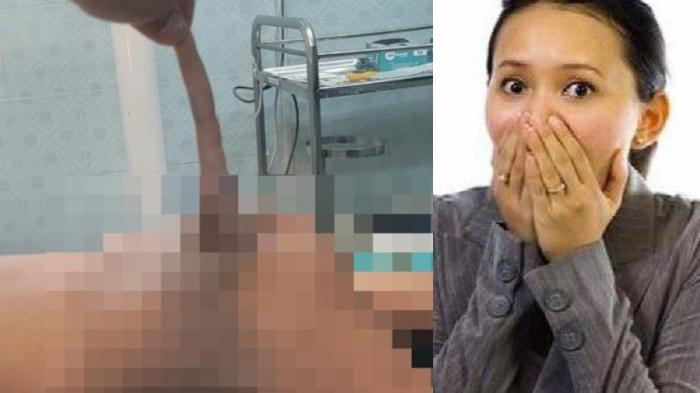LANGKA! Bayi 4 Bulan Punya Ekor Sepanjang 14 Cm, Dokter Jelaskan Penyebabnya, Langsung Dioperasi