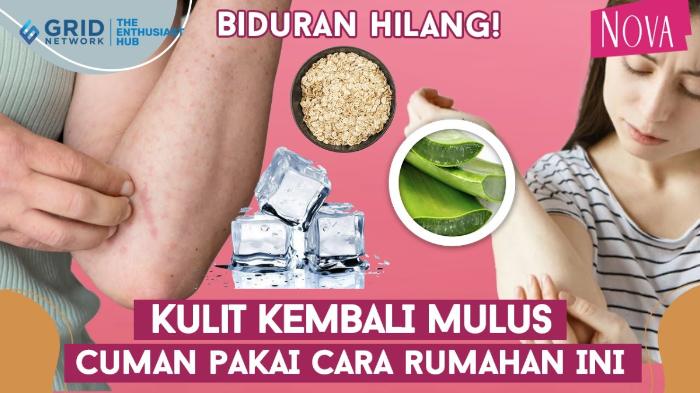 Cara-alami-atasi-biduran.jpg
