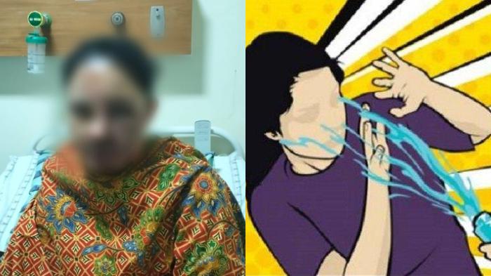 Pilu, Wanita di Makassar Tolak Rujuk Berujung Disiram Air Keras, Pengobatan Tak Ditanggung BPJS
