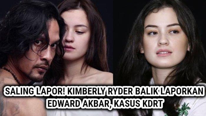 Bukti Kimberly Ryder Alami KDRT oleh Edward Akbar, Luka Tampar & Lebam: Adukan ke Komnas Perempuan