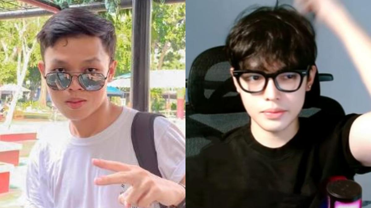 Selebgram Ini Habiskan 800 Juta untuk Oplas Wajah,  Sempat Sedih Saat Ngaca, 'Kangen Muka Lama'