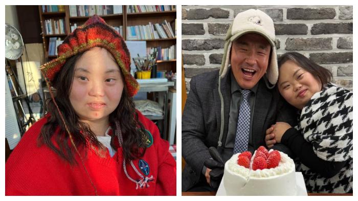 Sosok Jung Eun Hye, Aktris Korea Down Syndrome, Buat 3000 Lukisan Wajah, Tulis Buku, Nikah Mei 2025