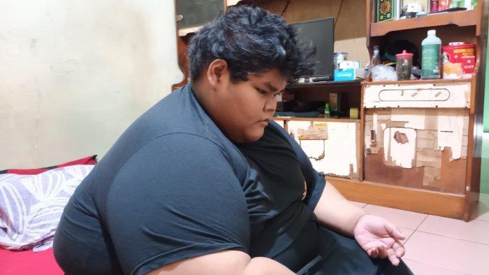 CURHATAN Remaja Obesitas 200 Kg di Jakarta, Ingin Kurus Tapi Gak Punya Biaya: 'Bermimpi Jadi Dokter'