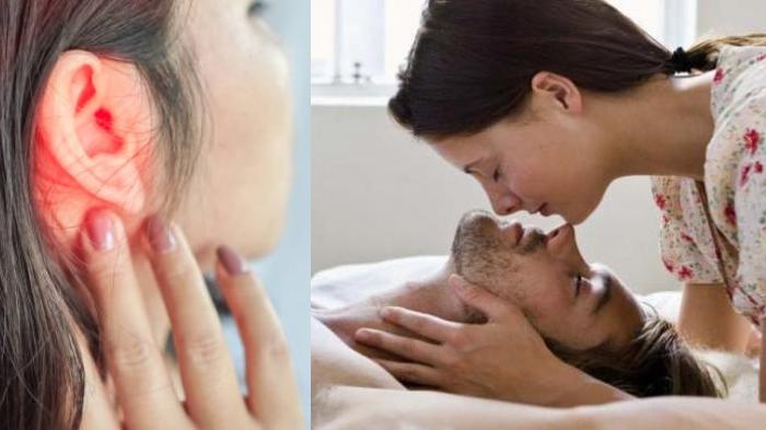 'Kupingku Dihisap' Langka! Gendang Telinga Wanita Ini Pecah saat Ciuman, Ada Darah, Dokter: Bahaya!