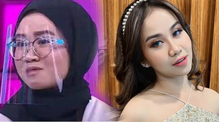 Sudah Glowing, Mayang Putri Doddy Sudrajat Masih Ingin Oplas Hidung Agar Mancung, 'Karena Ini Lebar'