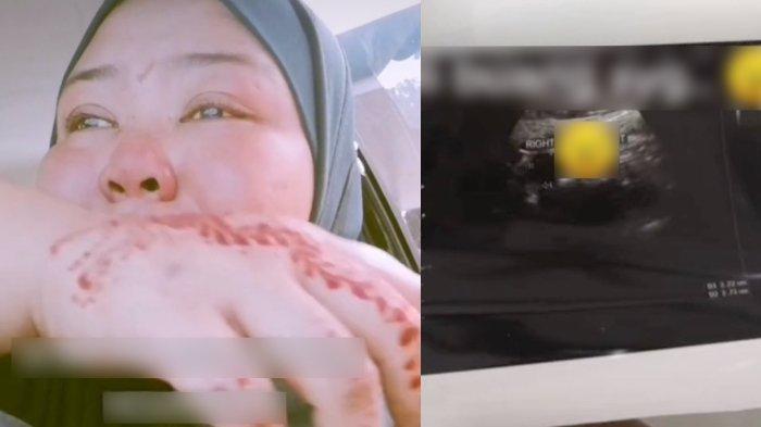 SAKIT Diabetes & Ginjal Bocor, Wanita Ini Pilu Tak Kunjung Punya Anak, 6 Kali Hamil Keguguran Semua