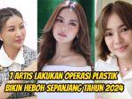 7-Artis-lakukan-operasi-plastik-hingga-bikin-heboh.jpg