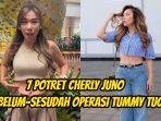 7-Potret-Cherly-Juno-eks-Cherrybelle-sebelum-sesudah-operasi-Tummy-Tuck.jpg