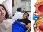 Berikut-ini-beberapa-artis-yang-sudah-pernah-merasakan-batu-ginjal.jpg