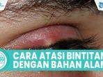 Cara-alami-obati-mata-bintitan.jpg