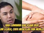 Presenter-Ivan-Gunawan-idap-asam-urat-ini-penyakitnya.jpg
