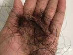 Sang-ibu-menemukan-banyak-rambut-yang-rontok-dari-kepala-putrinya.jpg