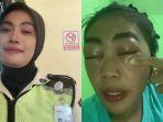 Satpam-cantik-syok-bibir-dan-matanya-mendadak-bengkak.jpg