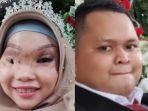 ayu-gadis-viral-korban-kecelakaan-perahu-resmi-menikah.jpg