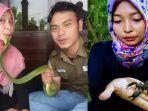 cerita-di-balik-foto-wanita-dagunya-digigit-ular-begini-kabarnya-sekarang.jpg