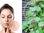 ilustrasi-wanita-berjerawat-dan-daun-binahong.jpg