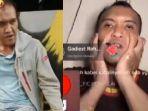kondisi-caisar-eks-yks-buat-netizen-khawatir.jpg