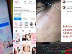mayang-mereview-skincare-yang-buat-wajahnya-rusak.jpg