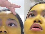 noda-kuning-dari-masker-kunyit-tak-bisa-hilang.jpg