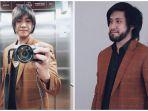 perubahan-kevin-aprilio-setelah-jalani-transplantasi-rambut.jpg