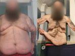 pria-berbobot-220-kg-turunkan-berat-badan-jadi-79-kg.jpg