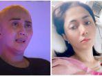 sedang-sakit-kanker-artis-ini-curhat-dianiaya-dituduh-rebut-suami-orang.jpg