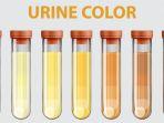 warna-urine-ilustrasi.jpg