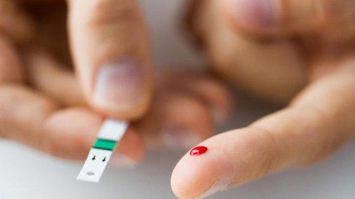 Cegah Tubuh Kekurangan Darah, Kenali 6 Gejala Anemia dan Pengobatan Alaminya