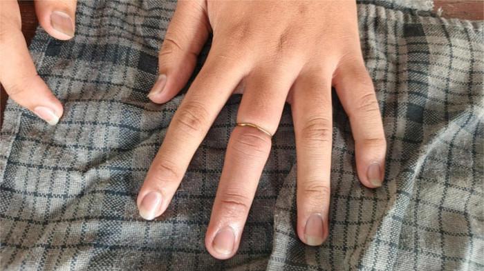 PELEPASAN CINCIN- Seorang pelajar Sekolah Menengah Pertama (SMP) di Kota Padang mendatangi Markas Komando (Mako) Dinas Pemadam Kebakaran (Damkar) Kota Padang untuk meminta bantuan petugas melepas cincin yang ada di jarinya, Kamis (6/11/2025).