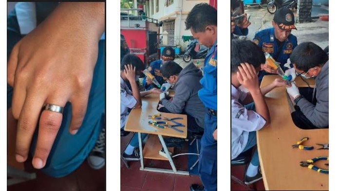 Cincin Titanium di Jari Rizky Harus Dipotong Mesin Petugas Damkar, Butuh Waktu 15 Menit Agar Lepas