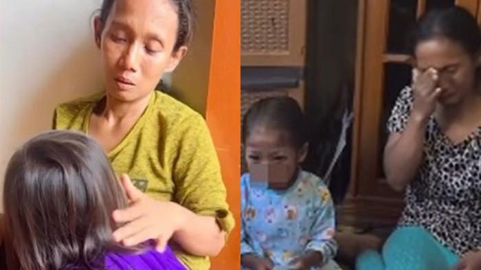 PENGERTIAN RACOON EYES - Kolase. Apa Itu Racoon Eyes, Kondisi yang Disebut Dokter Bedah Dialami Siswi SDN 150 Palembang