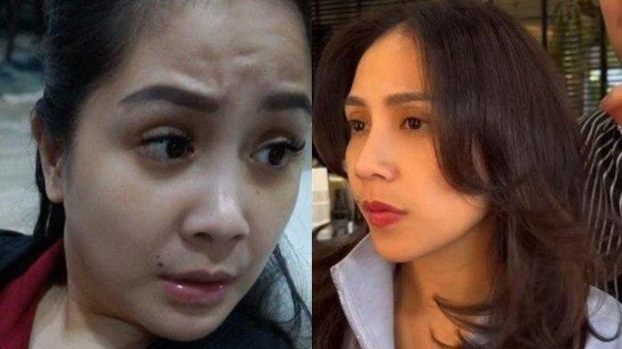 Bentuk Hidung Nagita Slavina Disorot, Istri Raffi Ahmad Ikut Tren Operasi Plastik Efek Makin Mancung