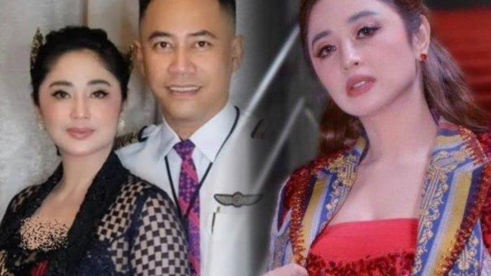 Dewi Perssik sikap sikap cemburu Rully