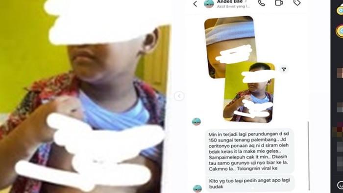 HEBOH Anak SD 150 Sungai Tenang Palembang Dibully, Badan Melepuh Disiram Kuah Mi Gelas Teman Sekelas