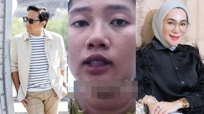 TELEPON ANDRE TAULANY - Kolase Andre Taulany (kiri) Hera, ART Erin taulany (tengah), Rien Wartia Trigina alias  Erin (kanan). Hera mengaku mengalami penganiayaan oleh Rien Wartia Trigina saat baru kurang dari sebulan bekerja, termasuk dipukul dan ditendang di kepala.