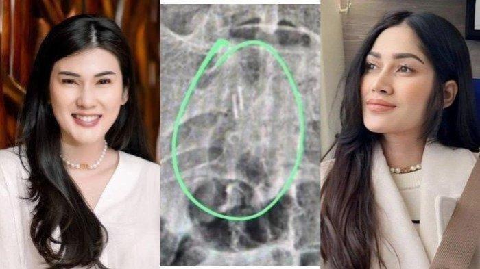 Bukti Icha Annisa Bukan Orang yang Santet Stevie Agnecya Dikuak, Elly Sugigi Sindir Manusia Bersisik